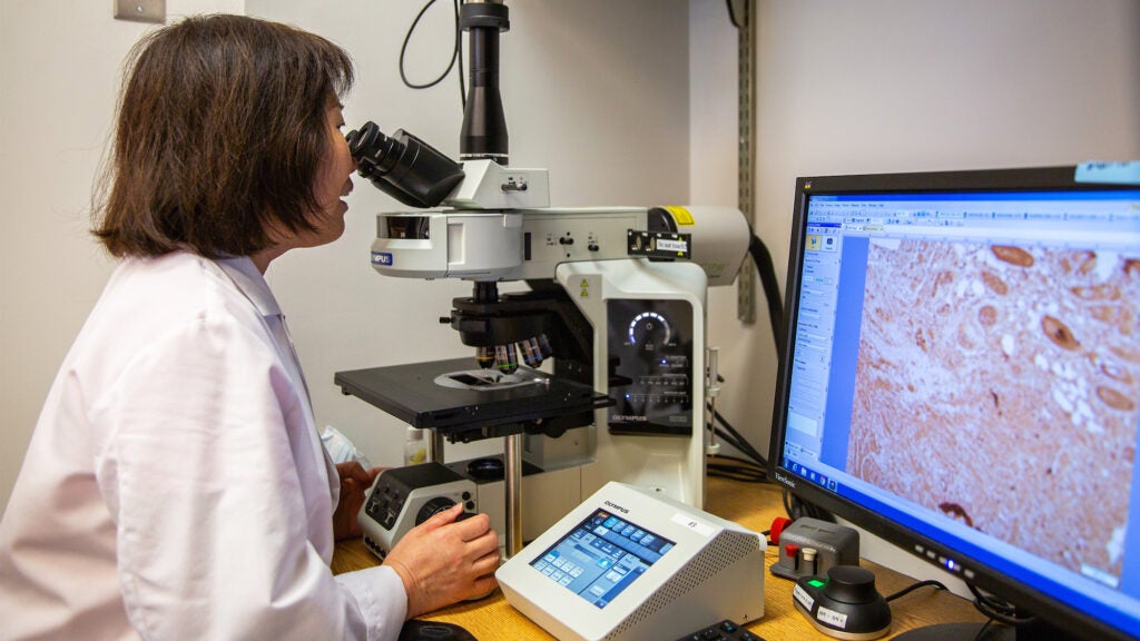 A cancer researcher works at a microscope