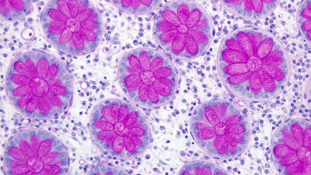 Gut wall cells viewed through a microscope