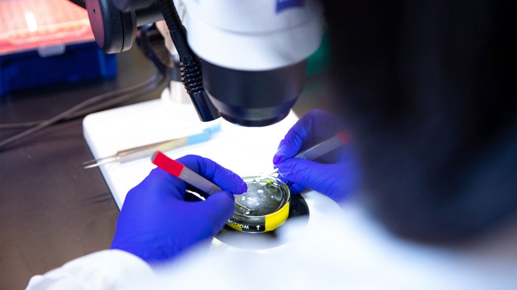 A researcher's gloved hands are visible as they adjust a specimen using tweezers under a microscope